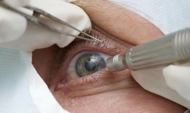Abril Marrom educa as pessoas sobre doenças que podem acometer os olhos e ser detectadas preventivamente.