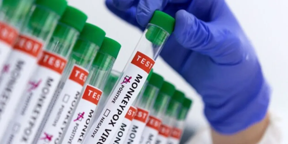 Caso foi confirmado pela Secretaria de Saúde de São Paulo