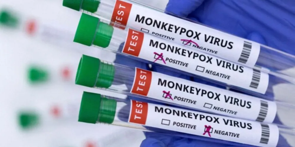 O estado com mais casos confirmados é São Paulo com 52.