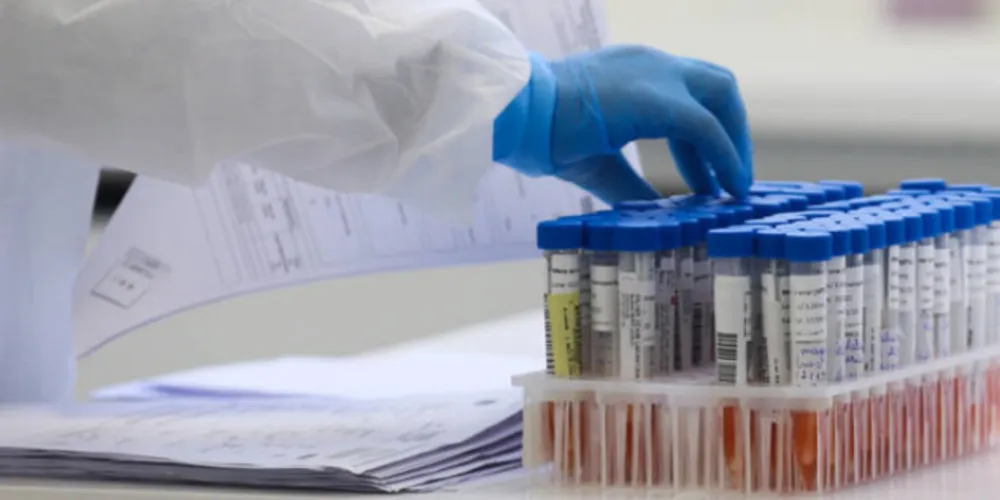 Brasil registra 115 mortes por Covid e mais de 10 mil casos