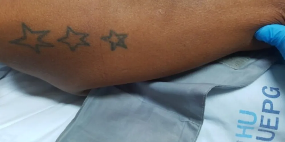 UEPG revelou algumas características do paciente para tentar a identificação