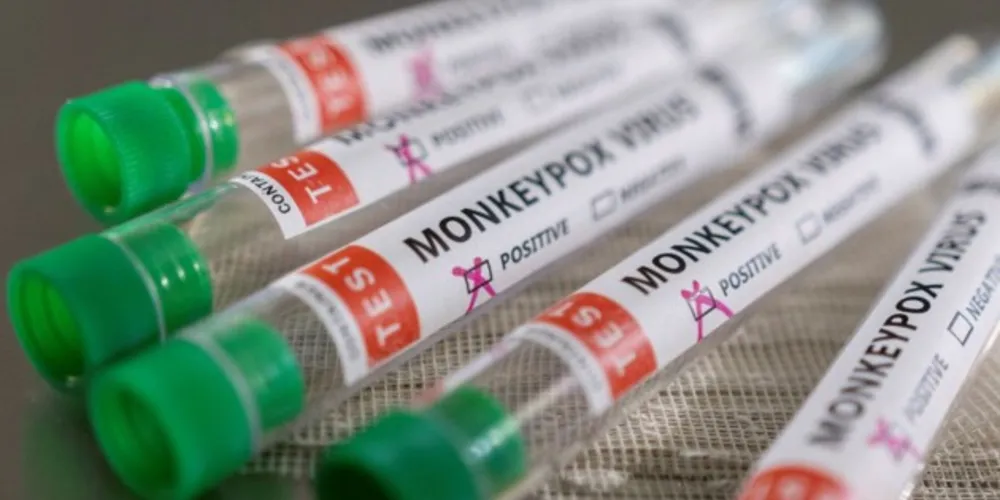 São Paulo confirmou o primeiro caso de varíola dos macacos no Brasil