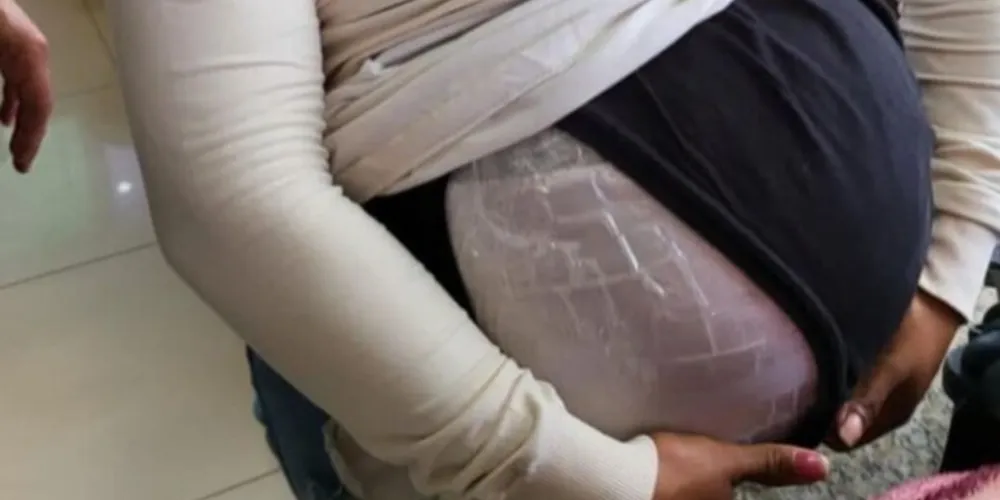 Cinta abdominal, escondia uma sacola com cerca de 6 quilos em sementes de maconha.