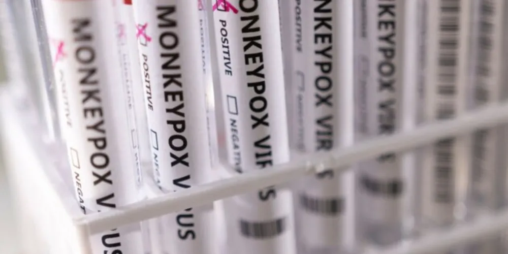 Na semana passada, duas outras ocorrências de varíola dos macacos foram confirmadas no estado.