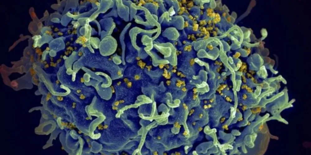 Eletromicrografia mostra HIV infectando célula humana