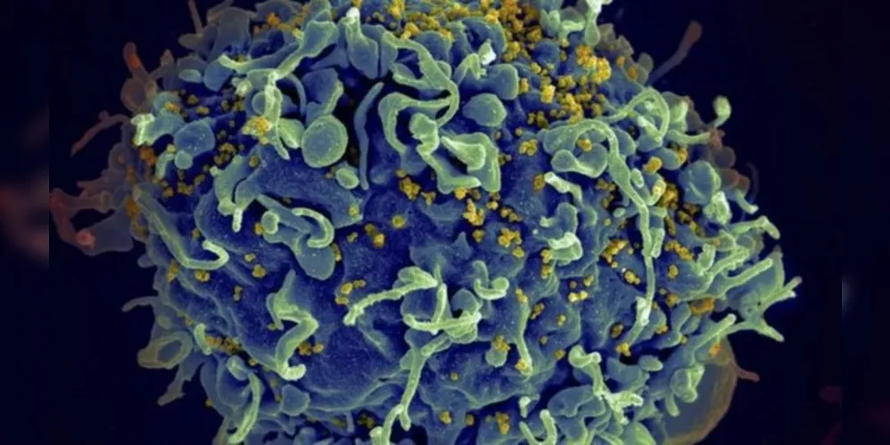 Eletromicrografia mostra HIV infectando célula humana