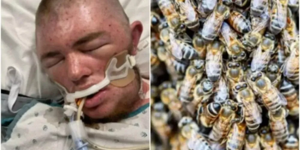 Vítima foi resgatada pelos bombeiros da região e levada em estado grave de helicóptero ao hospital