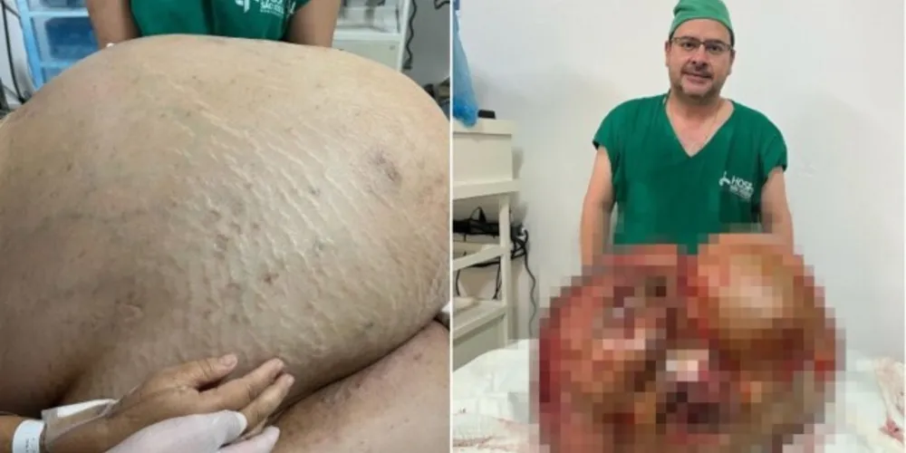 De acordo com médico, a paciente procurou o hospital com dificuldade para respirar