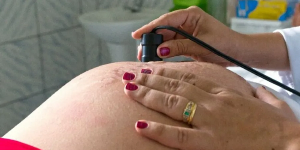 Lei reduz de 25 para 21 anos idade para esterilização voluntária