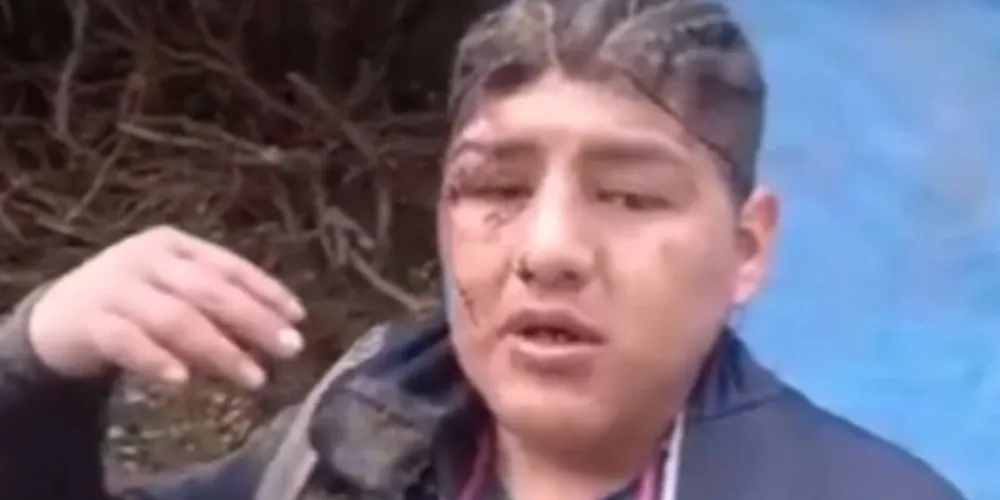 Victor Hugo Álvarez estava coberto de cimento no rosto e na cabeça. Ele não se recorda de como as coisas aconteceram