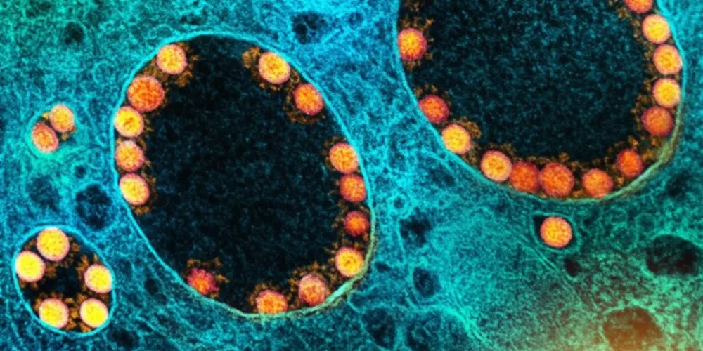 Vitamina pode contribuir para uma redução significativa de mortes por covid-19.