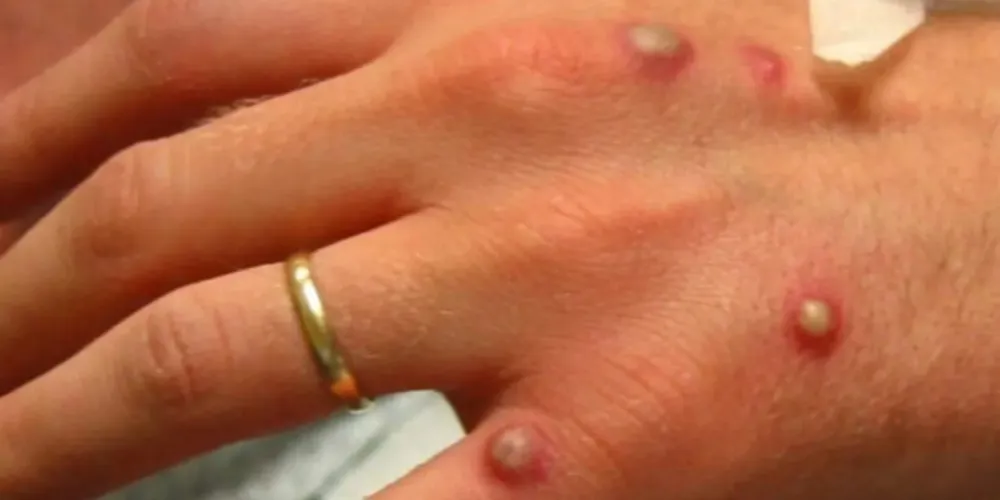 Paciente aguarda resultado de testes, mas já foi isolada