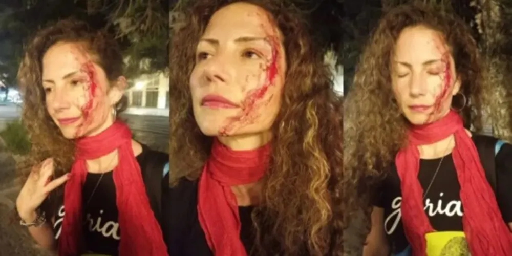 Jornalista teve um corte na face e levou vários pontos