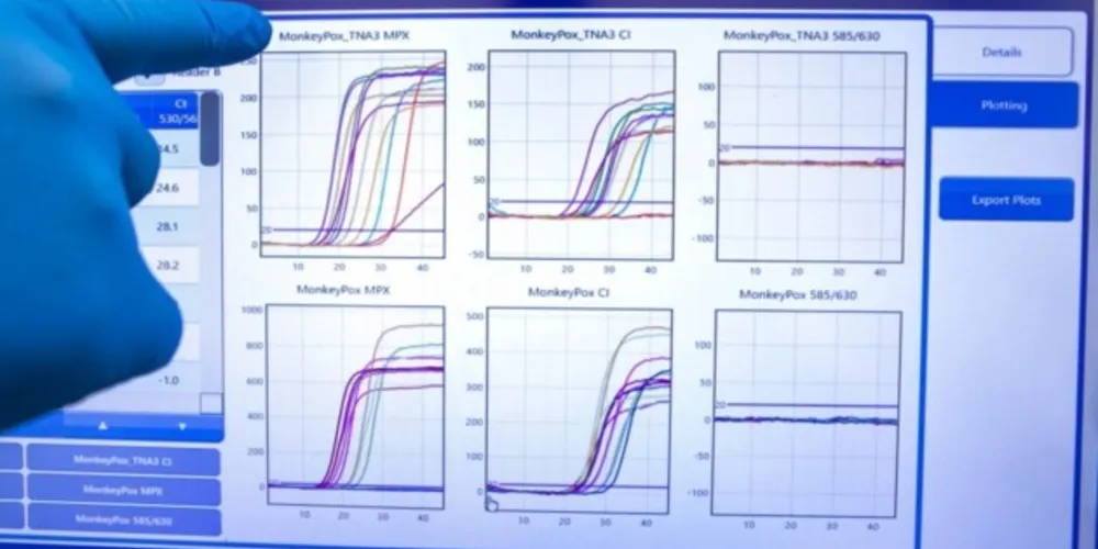 Ao todo, o Estado soma 259 diagnósticos positivos da doença, 103 suspeitos e nenhum óbito.