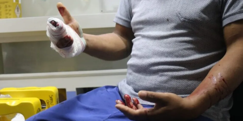 Segundo a vítima, o motivo da briga seria uma traição da mulher