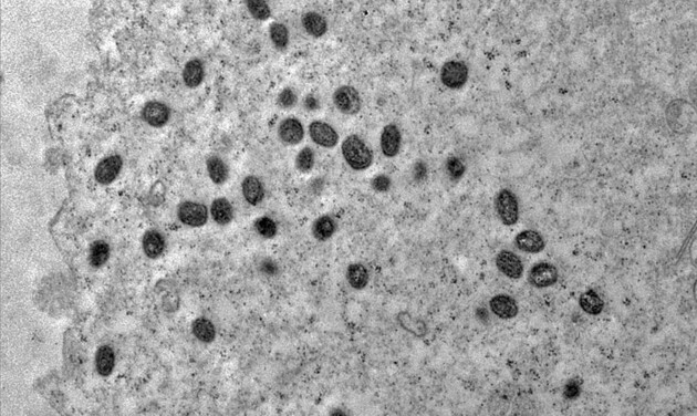 Até o momento, há 8.340 casos confirmados de varíola dos macacos no Brasil