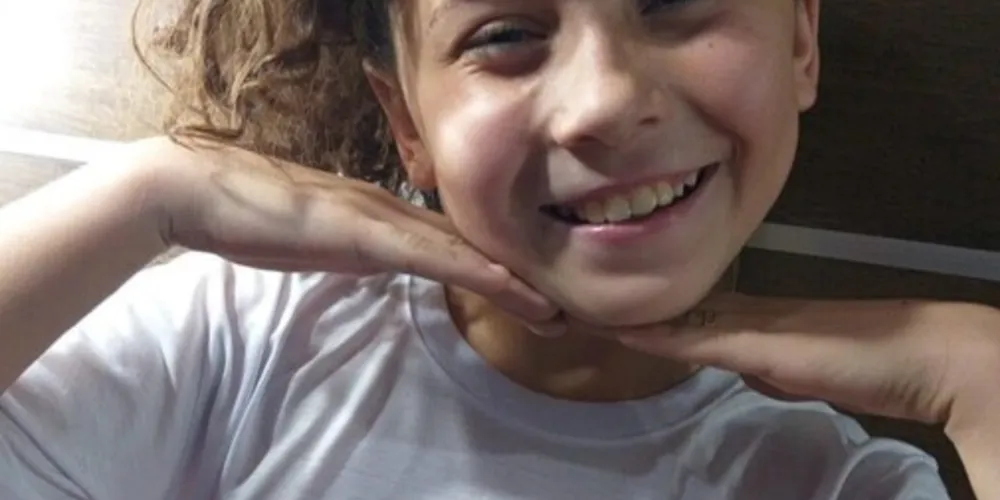 Ela teve 70% do corpo queimado