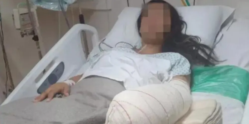 Gleice Kelly Gomes, de 24 anos, teve mão amputada após dar à luz