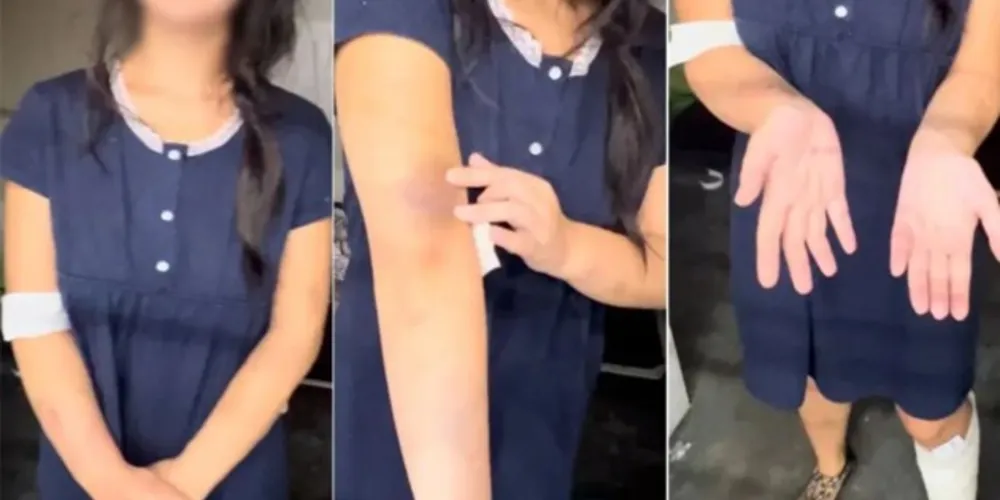 Em seu depoimento, a jovem disse que foi agredida com arma de choque pela mãe