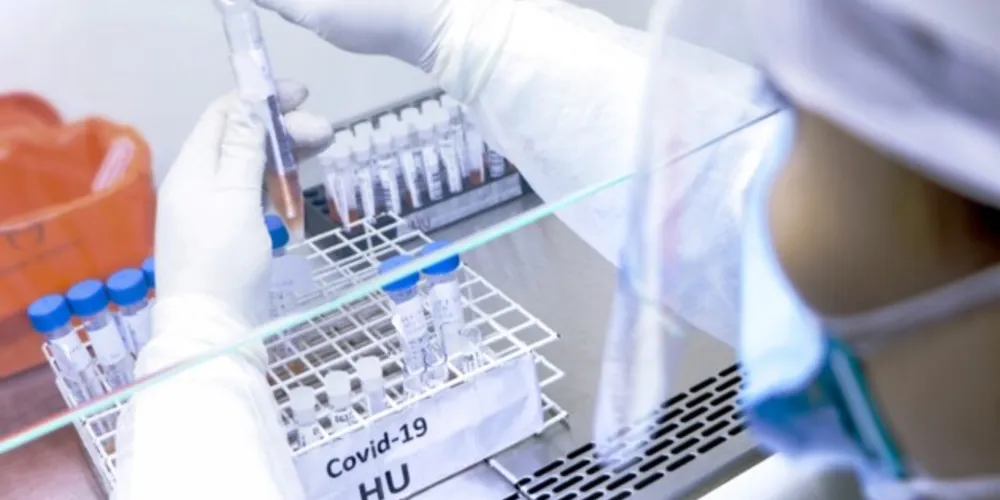 O boletim também traz a evolução de casos de Covid-19 ao longo do ano