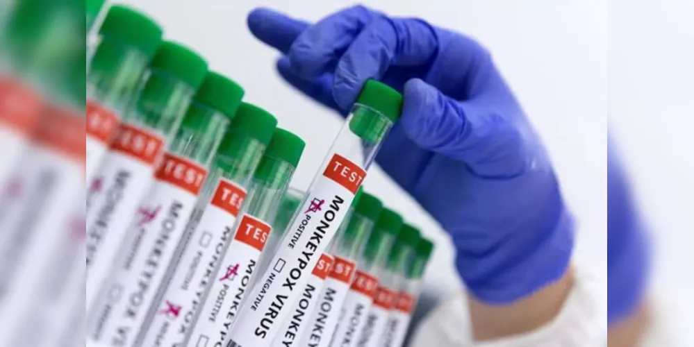 Ministério da Saúde enviou 951 doses ao Estado