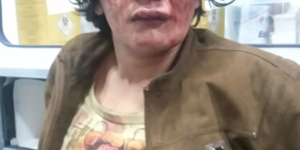 Vítima levou vários socos e chutes na cabeça