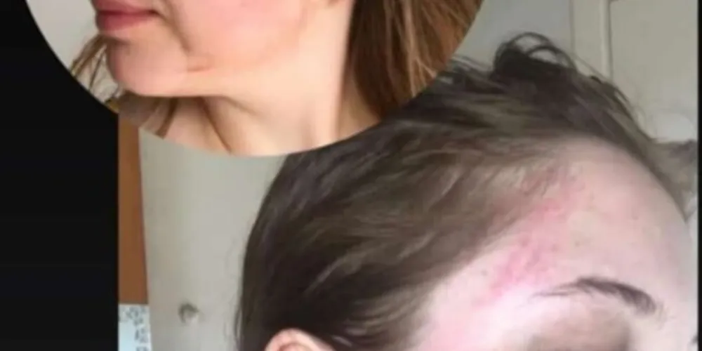 Fotos não são atuais e fazem parte de um procedimento do ano de 2021