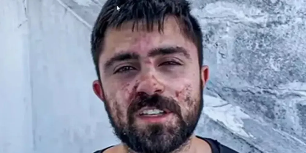 João Bettega gravou um vídeo sobre a situação