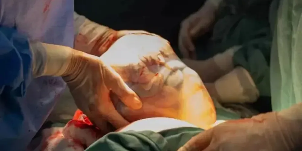 Momento raro foi registrado nas redes sociais da catarinense