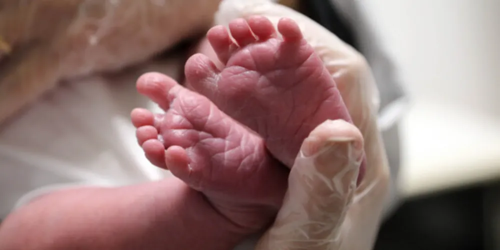 O Teste do Pezinho é um exame simples, realizado nos primeiros dias de vida da criança, ainda na maternidade ou nas Unidades Básicas de Saúde