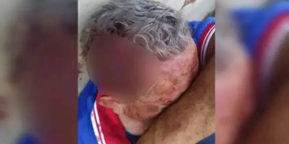 As agressões começaram quando o suspeito foi até sua antiga casa