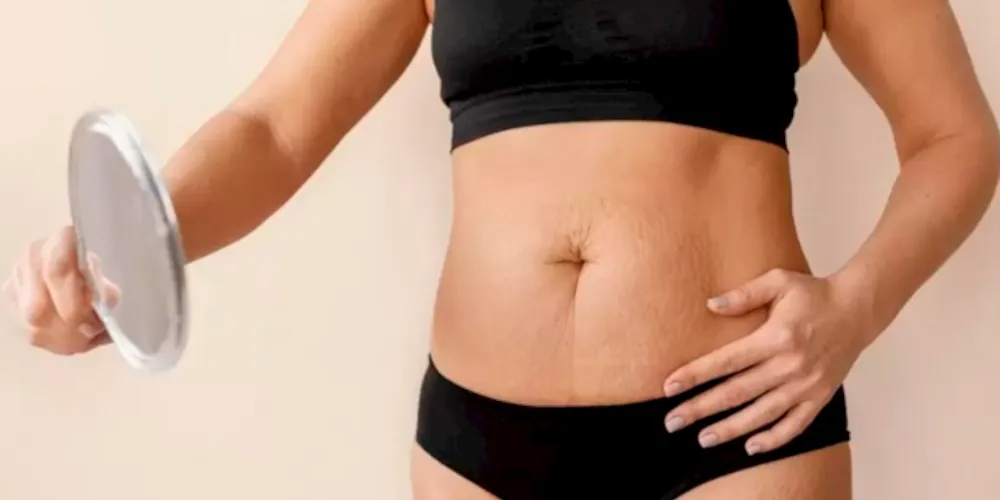 Mulher pós-gravidez insatisfeita com seu corpo