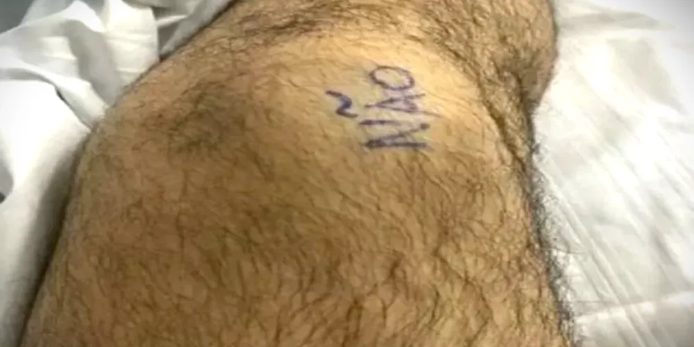 Homem rompeu o ligamento do joelho esquerdo e preferiu se prevenir