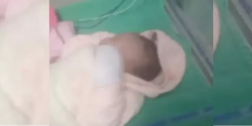 Bebê precisou voltar para atendimento após ferimento do corte feito em parto se abrir