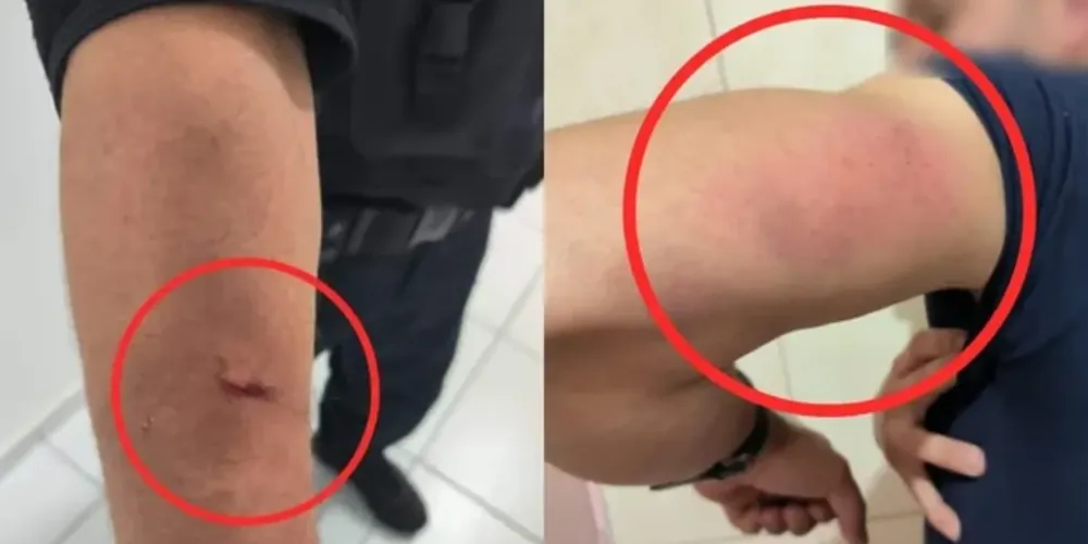 Qualquer forma de violência contra agentes de segurança constitui um crime