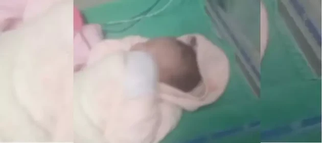 Bebê precisou voltar para atendimento após ferimento do corte feito em parto se abrir