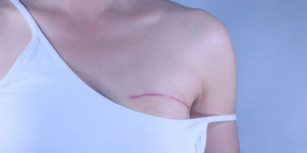 Os seios são um símbolo de feminilidade, da identidade sexual e materna da mulher