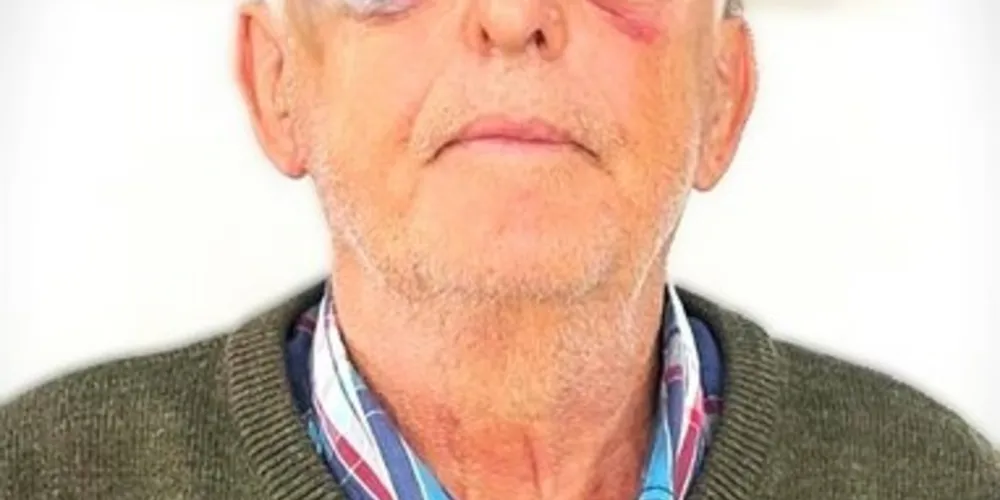 Idoso, de 75 anos, foi atacado com extrema violência