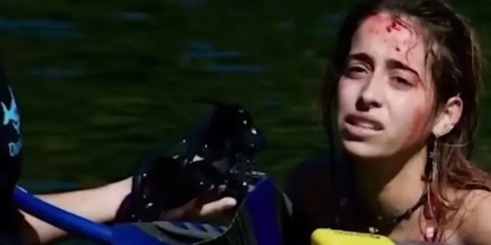 orte-americana foi mordida na cabeça por um crocodilo de quase três metros