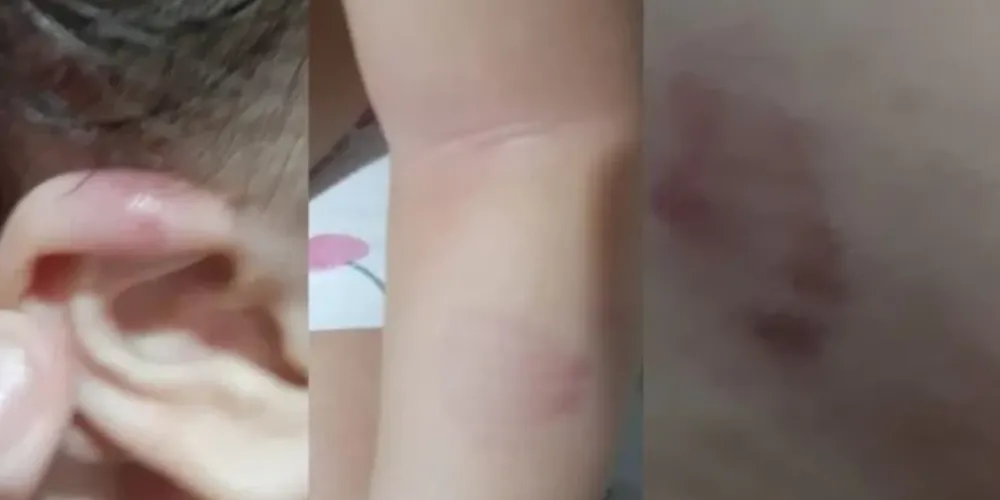 Ele e a esposa registraram um boletim de ocorrência contra a creche