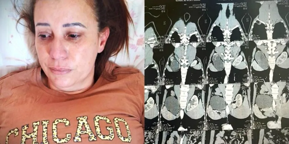 Mara Lucia precisa realizar uma cirurgia com o custo aproximado de R$ 20 mil