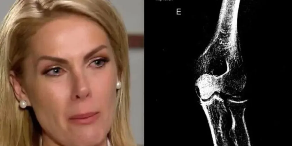 Ana Hickmann acusa o marido de agredi-la em casa, em Itu, no interior paulista