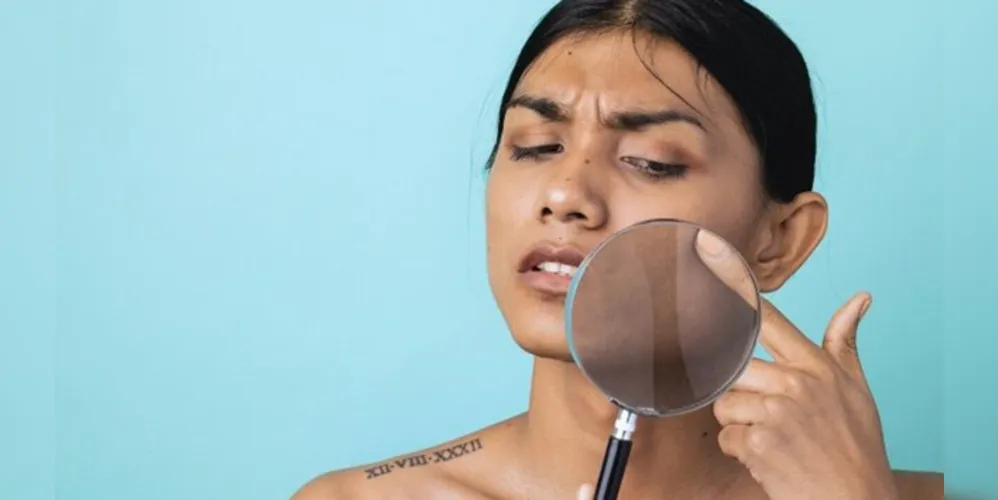 Pare de Esconder a sua Pele com Produtos que não vão Controlar o seu Melasma