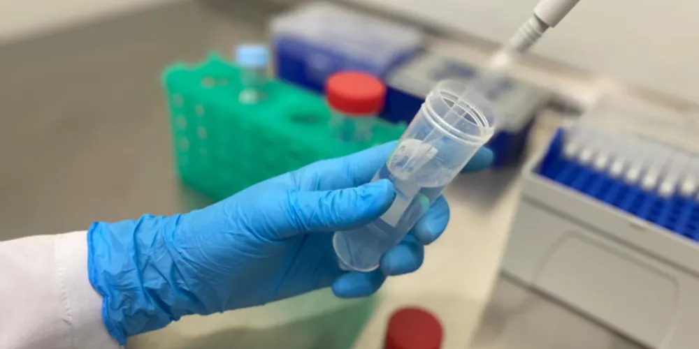 Das 355 propostas apresentadas pelos parceiros, 152 foram avaliadas pelos comitês da Ageuni