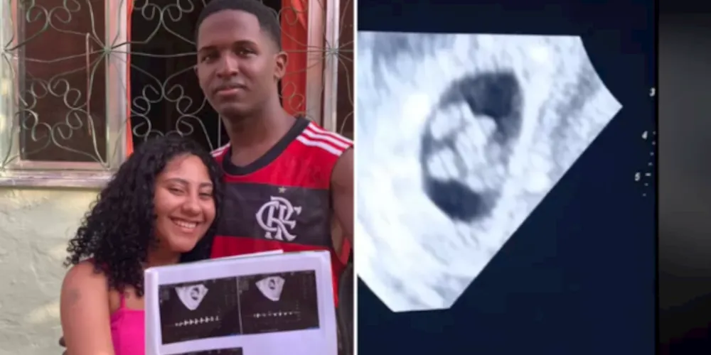 A gravidez, no entanto, era considerada de risco