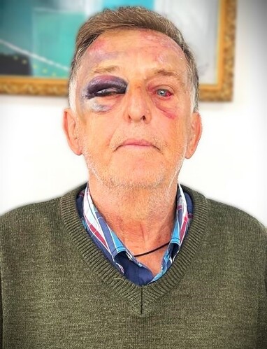 Idoso, de 75 anos, foi atacado com extrema violência