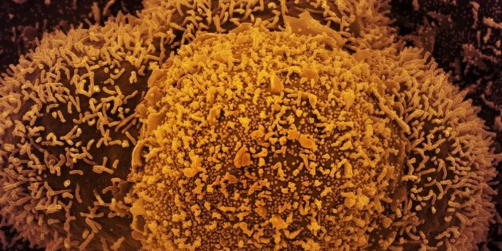 Subvariante foi identificada no Brasil