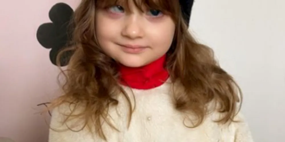 Nathalia, de 4 anos, nasceu com glaucoma congênito