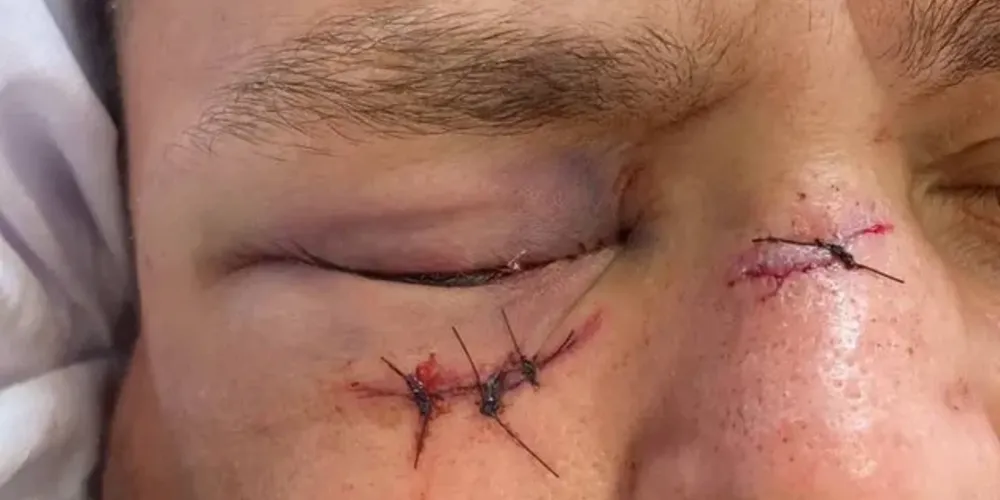 Veja o momento no vídeo