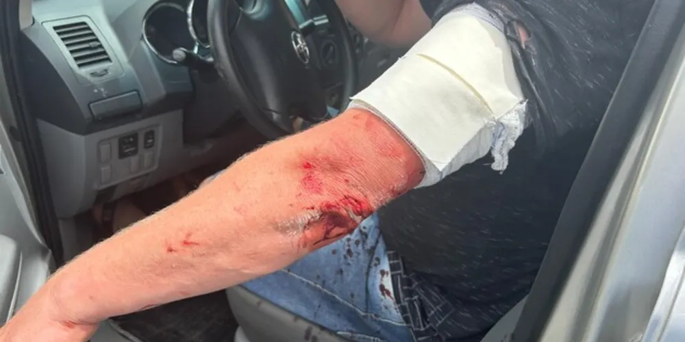 Após a agressão, irmão esfaqueado fugiu para não ser alvejado